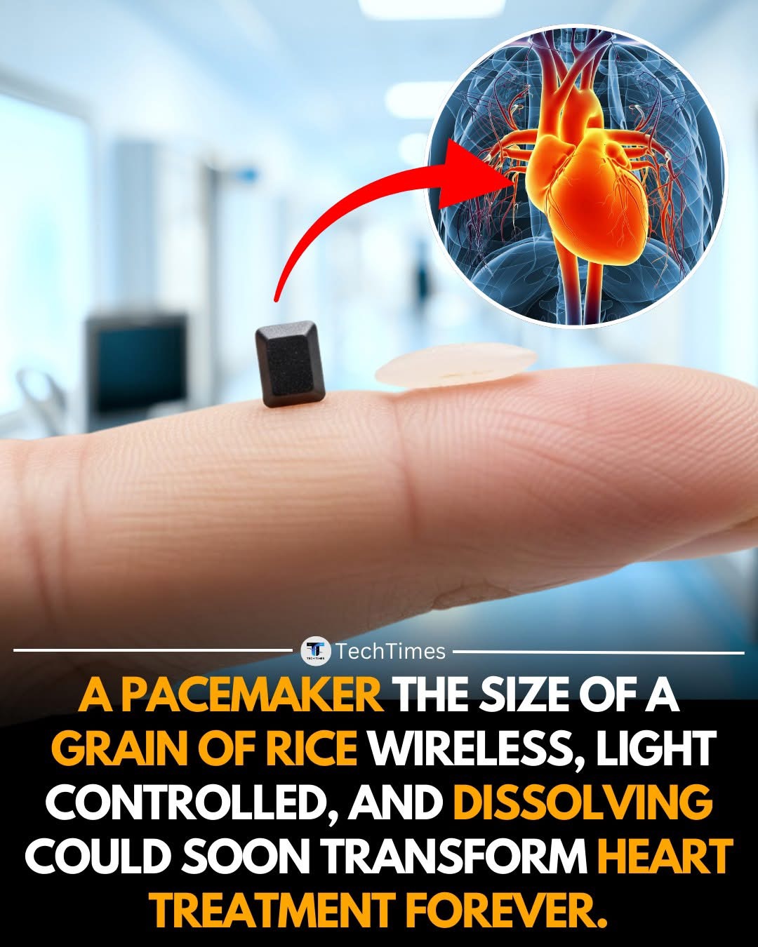SCIENTISTS HAVE DEVELOPED A PACEMAKER THE SIZE OF A GRAIN OF RICE — WIRELESS, LIGHT-CONTROLLED, AND DESIGNED TO DISSOLVE AFTER USE.