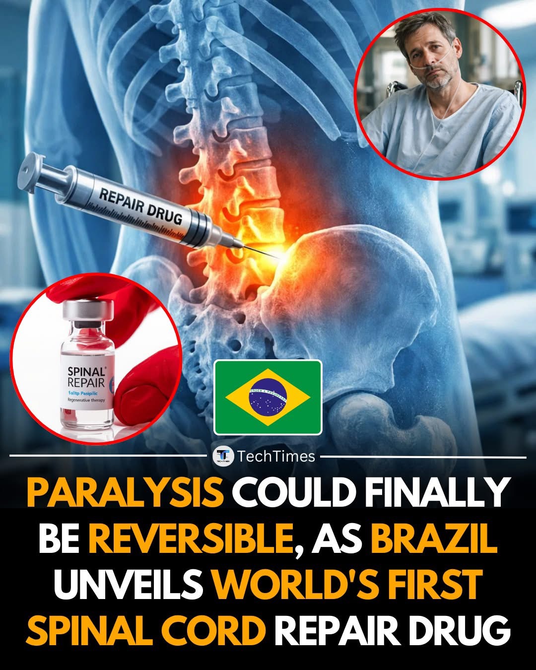BRAZIL HAS UNVEILED WHAT IS BEING DESCRIBED AS THE WORLD’S FIRST DRUG DESIGNED TO REPAIR SPINAL CORD DAMAGE